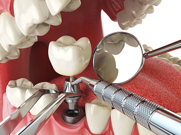 Best Emergency Gum Treatment in Jones Creek, TX