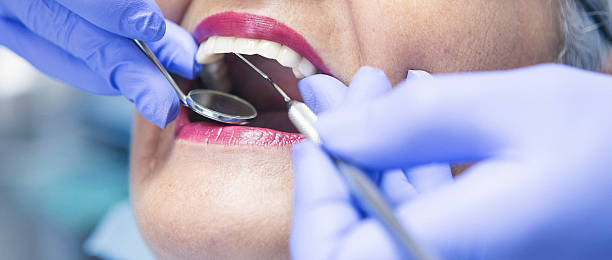 Best Emergency Treatment for Dental Infections or Abscesses in Jones Creek, TX